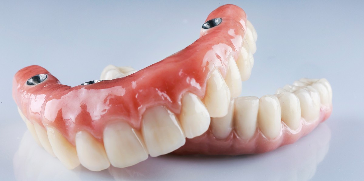Implant Dentures, All on Four